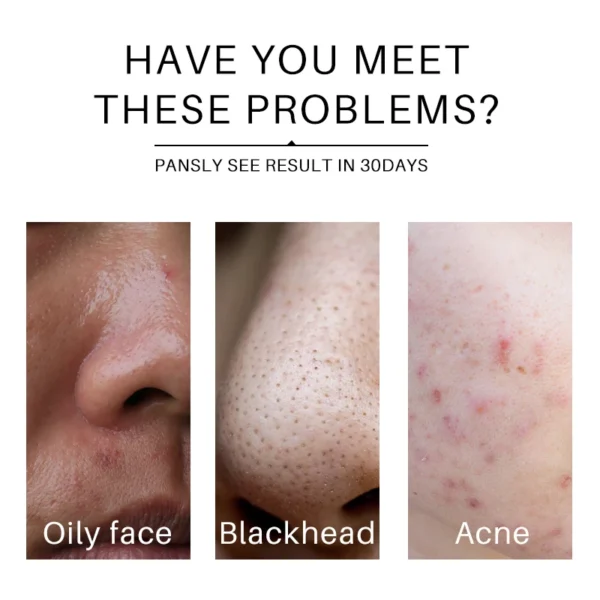 brightening anti acne spot cleansing balm cream mask oil tumeric serum turmeric skin care set face wash facial cleanser sets